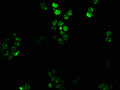 Immunofluorescence staining of PC3 cells with CSB-PA010677LA01HU at 1:100, counter-stained with DAPI. The cells were fixed in 4% formaldehyde, permeabilized using 0.2% Triton X-100 and blocked in 10% normal Goat Serum. The cells were then incubated with the antibody overnight at 4°C. The secondary antibody was Alexa Fluor 488-congugated AffiniPure Goat Anti-Rabbit IgG(H+L).
