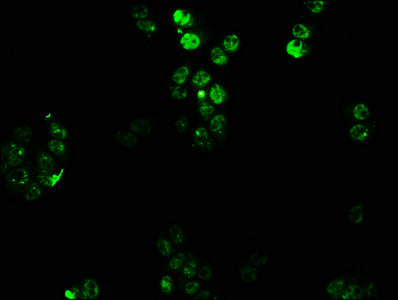 Immunofluorescence staining of PC3 cells with CSB-PA010677LA01HU at 1:100, counter-stained with DAPI. The cells were fixed in 4% formaldehyde, permeabilized using 0.2% Triton X-100 and blocked in 10% normal Goat Serum. The cells were then incubated with the antibody overnight at 4°C. The secondary antibody was Alexa Fluor 488-congugated AffiniPure Goat Anti-Rabbit IgG(H+L).