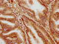 IHC image of CSB-PA010685LA01HU diluted at 1:400 and staining in paraffin-embedded human prostate tissue performed on a Leica BondTM system. After dewaxing and hydration, antigen retrieval was mediated by high pressure in a citrate buffer&nbsp;(pH 6.0). Section was blocked with 10% normal goat serum 30min at RT. Then primary antibody&nbsp;(1% BSA) was incubated at 4&deg;C overnight. The primary is detected by a biotinylated secondary antibody and visualized using an HRP conjugated SP system.
