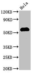 Western Blot
Positive WB detected in: Hela whole cell lysate
All lanes: HSF1 antibody at 3µg/ml
Secondary
Goat polyclonal to rabbit IgG at 1/50000 dilution
Predicted band size: 58, 53 kDa
Observed band size: 58 kDa