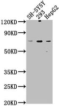 Western Blot
Positive WB detected in: SH-SY5Y whole cell lysate, 293 whole cell lysate, HepG2 whole cell lysate
All lanes: HSPA12A antibody at 1:1000
Secondary
Goat polyclonal to rabbit IgG at 1/50000 dilution
Predicted band size: 75 kDa
Observed band size: 75 kDa