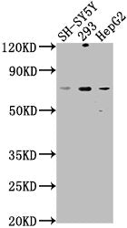 Western Blot
Positive WB detected in: SH-SY5Y whole cell lysate, 293 whole cell lysate, HepG2 whole cell lysate
All lanes: HSPA12A antibody at 1:1000
Secondary
Goat polyclonal to rabbit IgG at 1/50000 dilution
Predicted band size: 75 kDa
Observed band size: 75 kDa