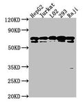 Western Blot
Positive WB detected in: HepG2 whole cell lysate, Jurkat whole cell lysate, L02 whole cell lysate, 293 whole cell lysate, Raji whole cell lysate
All lanes: HSPA1L antibody at 1:2000
Secondary
Goat polyclonal to rabbit IgG at 1/50000 dilution
Predicted band size: 71 kDa
Observed band size: 71 kDa