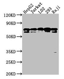 Western Blot
Positive WB detected in: HepG2 whole cell lysate, Jurkat whole cell lysate, L02 whole cell lysate, 293 whole cell lysate, Raji whole cell lysate
All lanes: HSPA1L antibody at 1:2000
Secondary
Goat polyclonal to rabbit IgG at 1/50000 dilution
Predicted band size: 71 kDa
Observed band size: 71 kDa