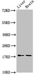 Western Blot
Positive WB detected in: Mouse liver tissue, Mouse brain tissue
All lanes: HSPB6 antibody at 3ug/ml
Secondary
Goat polyclonal to rabbit IgG at 1/50000 dilution
Predicted band size: 18 kDa
Observed band size: 18 kDa