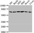 Western Blot
Positive WB detected in: 293 whole cell lysate, HepG2 whole cell lysate, 293T whole cell lysate, K562 whole cell lysate, Mouse brain tissue, Mouse liver tissue
All lanes: HSPD1 antibody at 1:2000
Secondary
Goat polyclonal to rabbit IgG at 1/50000 dilution
Predicted band size: 62, 18 kDa
Observed band size: 62 kDa