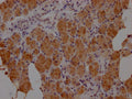 IHC image of CSB-PA010879NA01HU diluted at 1:100 and staining in paraffin-embedded human salivary gland tissue performed on a Leica BondTM system. After dewaxing and hydration, antigen retrieval was mediated by high pressure in a citrate buffer (pH 6.0). Section was blocked with 10% normal goat serum 30min at RT. Then primary antibody (1% BSA) was incubated at 4°C overnight. The primary is detected by a Goat anti-rabbit IgG labeled by HRP and visualized using 0.05% DAB.