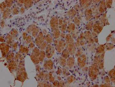 IHC image of CSB-PA010879NA01HU diluted at 1:100 and staining in paraffin-embedded human salivary gland tissue performed on a Leica BondTM system. After dewaxing and hydration, antigen retrieval was mediated by high pressure in a citrate buffer (pH 6.0). Section was blocked with 10% normal goat serum 30min at RT. Then primary antibody (1% BSA) was incubated at 4°C overnight. The primary is detected by a Goat anti-rabbit IgG labeled by HRP and visualized using 0.05% DAB.