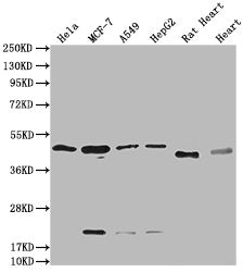 Western Blot
Positive WB detected in: Hela whole cell lysate, MCF-7 whole cell lysate, A549 whole cell lysate, HepG2 whole cell lysate, Rat Heart tissue, Mouse Heart tissue
All lanes: HTR3E antibody at 1:2000
Secondary
Goat polyclonal to rabbit IgG at 1/50000 dilution
Predicted band size: 52, 50, 53, 51, 54 kDa
Observed band size: 50 kDa