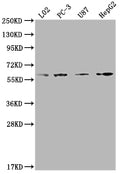 Western Blot
Positive WB detected in: L02 whole cell lysate, PC-3 whole cell lysate, U87 whole cell lysate, HepG2 whole cell lysate
All lanes: ICAM3 antibody at 1:2000
Secondary
Goat polyclonal to rabbit IgG at 1/50000 dilution
Predicted band size: 60 kDa
Observed band size: 60 kDa