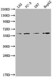 Western Blot
Positive WB detected in: L02 whole cell lysate, PC-3 whole cell lysate, U87 whole cell lysate, HepG2 whole cell lysate
All lanes: ICAM3 antibody at 1:2000
Secondary
Goat polyclonal to rabbit IgG at 1/50000 dilution
Predicted band size: 60 kDa
Observed band size: 60 kDa