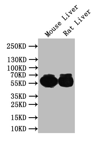 Western Blot
Positive WB detected in: Mouse Liver tissue lysate, Rat Liver tissue lysate
All lanes: IFIT1 antibody at 1:1000
Secondary
Goat polyclonal to rabbit IgG at 1/50000 dilution
Predicted band size: 56 kDa
Observed band size: 56 kDa