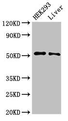 Western Blot
Positive WB detected in: HEK293 whole cell lysate, Rat liver tissue
All lanes: IFIT2 antibody at 3µg/ml
Secondary
Goat polyclonal to rabbit IgG at 1/50000 dilution
Predicted band size: 55 kDa
Observed band size: 55 kDa