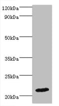 Western blot
All lanes: IFNA4 antibody at 2µg/ml + Mouse kidney tissue
Secondary
Goat polyclonal to rabbit IgG at 1/10000 dilution
Predicted band size: 22 kDa
Observed band size: 22 kDa