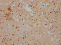 IHC image of CSB-PA011069LA01HU diluted at 1:500 and staining in paraffin-embedded human brain tissue performed on a Leica BondTM system. After dewaxing and hydration, antigen retrieval was mediated by high pressure in a citrate buffer (pH 6.0). Section was blocked with 10% normal goat serum 30min at RT. Then primary antibody (1% BSA) was incubated at 4°C overnight. The primary is detected by a Goat anti-rabbit IgG labeled by HRP and visualized using 0.05% DAB.
