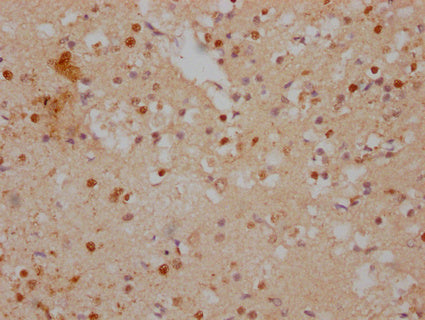 IHC image of CSB-PA011069LA01HU diluted at 1:500 and staining in paraffin-embedded human brain tissue performed on a Leica BondTM system. After dewaxing and hydration, antigen retrieval was mediated by high pressure in a citrate buffer (pH 6.0). Section was blocked with 10% normal goat serum 30min at RT. Then primary antibody (1% BSA) was incubated at 4°C overnight. The primary is detected by a Goat anti-rabbit IgG labeled by HRP and visualized using 0.05% DAB.