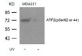 Western blot analysis of extracts from MDA231 cells untreated or treated with UV using ATF2(Phospho-Ser62 or 44) Antibody.