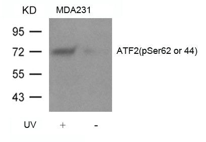 Western blot analysis of extracts from MDA231 cells untreated or treated with UV using ATF2(Phospho-Ser62 or 44) Antibody.