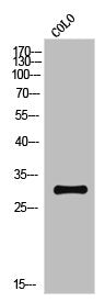 Western Blot analysis of COLO cells using IL-15Rα Polyclonal Antibody
