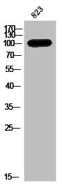 Western Blot analysis of 823 cells using AR Polyclonal Antibody
