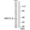 Western blot analysis of extracts from COLO205 cells, using ORCTL-2 antibody.