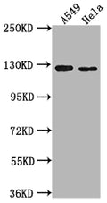 Western Blot
Positive WB detected in: A549 whole cell lysate, Hela whole cell lysate
All lanes: IGSF3 antibody at 1:2000
Secondary
Goat polyclonal to rabbit IgG at 1/50000 dilution
Predicted band size: 136, 138 kDa
Observed band size: 125 kDa
