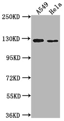 Western Blot
Positive WB detected in: A549 whole cell lysate, Hela whole cell lysate
All lanes: IGSF3 antibody at 1:2000
Secondary
Goat polyclonal to rabbit IgG at 1/50000 dilution
Predicted band size: 136, 138 kDa
Observed band size: 125 kDa