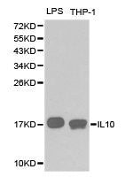 Western blot analysis of extracts of various cell lines, using IL10 antibody.