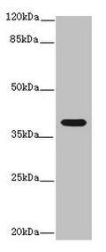 IL12B Antibody, HRP conjugated – Figure 1 of 3