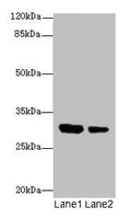 Western blot
All lanes: IL1A antibody at 6µg/ml
Lane 1: Jurkat whole cell lysate
Lane 2: Human placenta tissue
Secondary
Goat polyclonal to rabbit IgG at 1/10000 dilution
Predicted band size: 31 kDa
Observed band size: 31 kDa