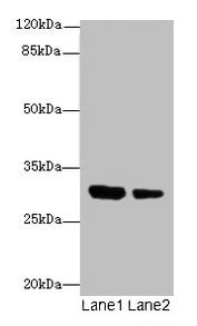 Western blot
All lanes: IL1A antibody at 6µg/ml
Lane 1: Jurkat whole cell lysate
Lane 2: Human placenta tissue
Secondary
Goat polyclonal to rabbit IgG at 1/10000 dilution
Predicted band size: 31 kDa
Observed band size: 31 kDa