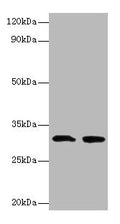 IL1B Antibody, FITC conjugated – Figure 1 of 1