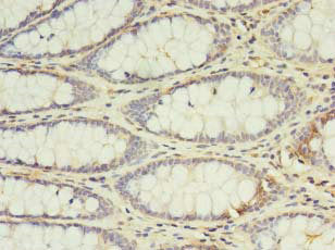 IL2 Antibody, HRP conjugated – Figure 1 of 1