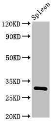 Western Blot
Positive WB detected in: Rat spleen tissue
All lanes: IL2RA antibody at 3.2ug/ml
Secondary
Goat polyclonal to rabbit IgG at 1/50000 dilution
Predicted band size: 31 kDa
Observed band size: 31 kDa