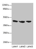 IL2RG Antibody, FITC conjugated – Figure 1 of 2