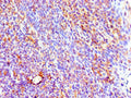 Immunohistochemistry of paraffin-embedded human tonsil tissue using CSB-PA011652ESR1HU at dilution of 1:100