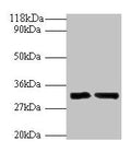 Western blot
All lanes: IL-33 antibody at 2µg/ml
Lane 1: Hela whole cell lysate
Lane 2: Mouse lung tissue
Secondary
Goat polyclonal to rabbit IgG at 1/10000 dilution
Predicted band size: 32 kDa
Observed band size: 32 kDa