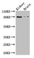 Western Blot
Positive WB detected in: Mouse kidney tissue, Mouse brain tissue
All lanes: IL4 antibody at 3ug/ml
Secondary
Goat polyclonal to rabbit IgG at 1/50000 dilution
Predicted band size: 18, 16 kDa
Observed band size: 90 kDa
