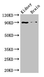 Western Blot
Positive WB detected in: Mouse kidney tissue, Mouse brain tissue
All lanes: IL4 antibody at 3ug/ml
Secondary
Goat polyclonal to rabbit IgG at 1/50000 dilution
Predicted band size: 18, 16 kDa
Observed band size: 90 kDa