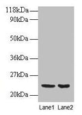 Western blot
All lanes: PRDX1 antibody at 2µg/ml
Lane 1: EC109 whole cell lysate
Lane 2: 293T whole cell lysate
Secondary
Goat polyclonal to rabbit IgG at 1/15000 dilution
Predicted band size: 23 kDa
Observed band size: 23 kDa