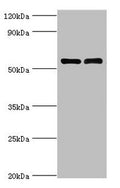 Western blot
All lanes: IL7R antibody at 4µg/ml
Lane 1: K562 whole cell lysate
Lane 2: Jurkat whole cell lysate
Secondary
Goat polyclonal to rabbit IgG&nbsp;at 1/10000 dilution
Predicted band size: 52, 35, 30, 29 kDa
Observed band size: 52 kDa
&nbsp;