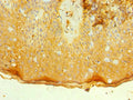 Immunohistochemistry of paraffin-embedded human skin tissue using CSB-PA011670ESR2HU at dilution of 1:100