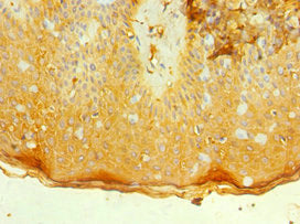 Immunohistochemistry of paraffin-embedded human skin tissue using CSB-PA011670ESR2HU at dilution of 1:100