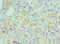 Immunohistochemistry of paraffin-embedded human kidney tissue using CSB-PA011675ESR2HU at dilution of 1:100