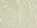 Immunohistochemistry of paraffin-embedded human brain tissue using CSB-PA011676ESR2HU at dilution of 1:100