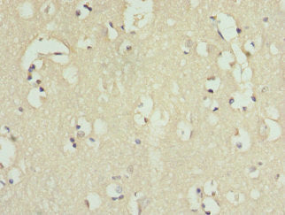 Immunohistochemistry of paraffin-embedded human brain tissue using CSB-PA011676ESR2HU at dilution of 1:100