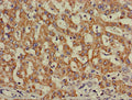INSR Antibody – Figure 1 of 3