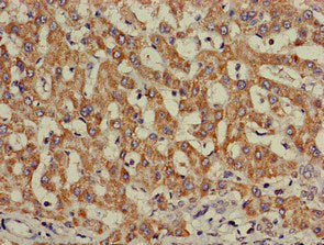 INSR Antibody – Figure 1 of 3