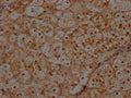IHC image of CSB-PA011758LA01HU diluted at 1:300 and staining in paraffin-embedded human adrenal gland tissue performed on a Leica BondTM system. After dewaxing and hydration, antigen retrieval was mediated by high pressure in a citrate buffer (pH 6.0). Section was blocked with 10% normal goat serum 30min at RT. Then primary antibody (1% BSA) was incubated at 4°C overnight. The primary is detected by a Goat anti-rabbit polymer IgG labeled by HRP and visualized using 0.05% DAB.