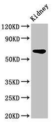 Western Blot
Positive WB detected in: Rat kidney tissue
All lanes: IPP antibody at 3.2ug/ml
Secondary
Goat polyclonal to rabbit IgG at 1/50000 dilution
Predicted band size: 66 kDa
Observed band size: 66 kDa
